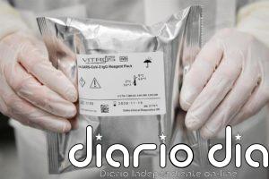 China asegura que ninguna de las cepas vivas de coronavirus que estudiaba se corresponde con la pandemia