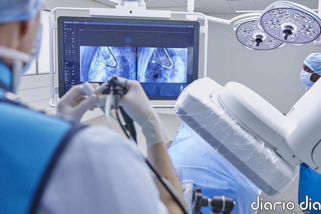 COMUNICADO: Philips acelera el diagnóstico y el tratamiento del cáncer de pulmón con Azurion Lung Edition