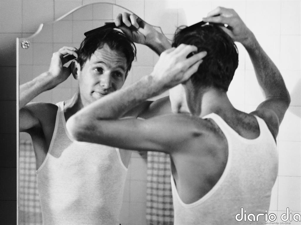 ¿Estás pensando hacerte un trasplante de pelo? Te damos las claves de cómo y dónde te lo puedes hacer