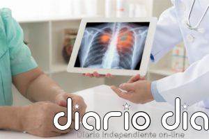 Pacientes con cáncer de pulmón y tumores hematológicos, los de peor pronóstico ante la COVID-19