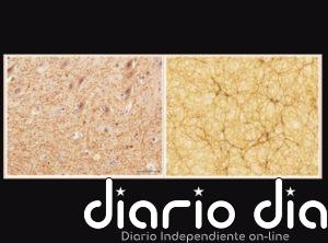 Cerebro y red cósmica de galaxias se parecen sorprendentemente