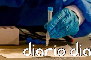 Aragón notifica 189 nuevos casos de COVID-19, 149 de ellos en la provincia de Zaragoza