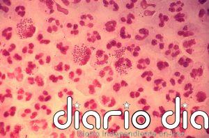 Baleares detectó 416 casos de gonorrea en 2019, 14 de ellos relacionados con prostitución