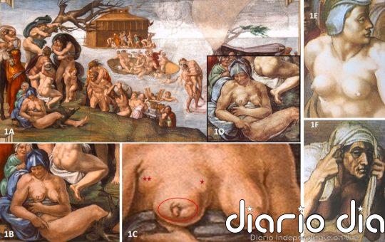 Miguel Ángel pintó en la Capilla Sixtina una mujer con signos de cáncer de mama