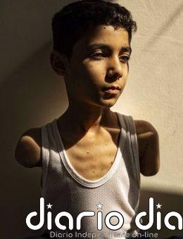 La imagen de Mahmoud, un niño mutilado de Gaza, foto del año del World Press Photo