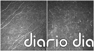 Un estudio clínico liderado por el IN revela que la aniridia provoca una pérdida progresiva de sensibilidad en la córnea