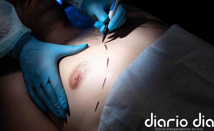 Cómo distinguir si es ginecomastia o grasa en el pecho