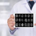 Estas enfermedades podrían predecir el Alzheimer hasta 10 años antes de los síntomas y abren la puerta a la prevención