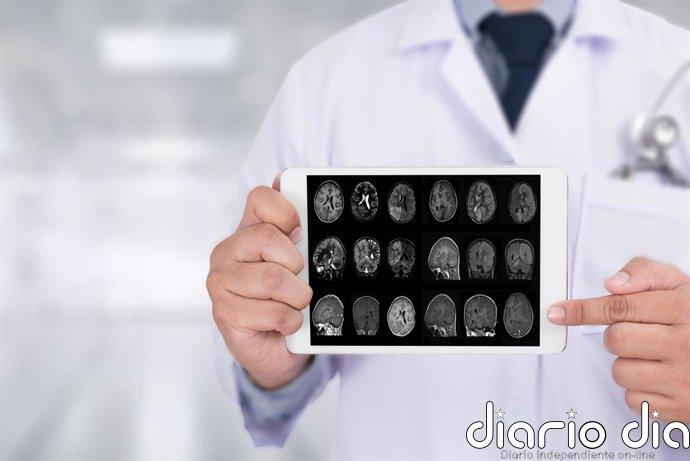 Estas enfermedades podrían predecir el Alzheimer hasta 10 años antes de los síntomas y abren la puerta a la prevención