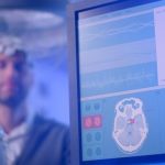 La compleja huella genética de las epilepsias comunes: así se reescribe el mapa del riesgo con los últimos estudios