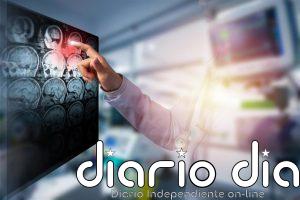 La inteligencia artificial mejora el tratamiento del ictus: este sistema ayuda a reducir nuevos eventos en pacientes