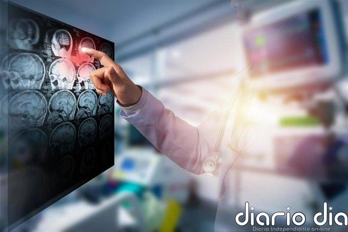 La inteligencia artificial mejora el tratamiento del ictus: este sistema ayuda a reducir nuevos eventos en pacientes
