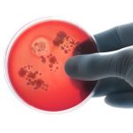 La meningitis sigue siendo una amenaza global: más de 250.000 muertes en 2023 pese al avance de las vacunas