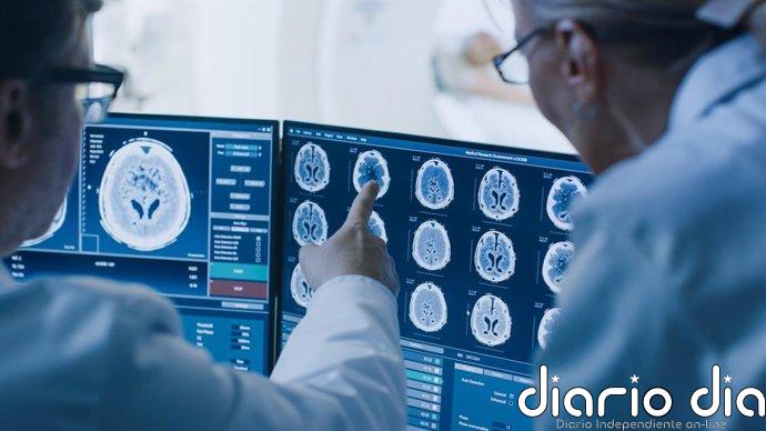 Un hallazgo revela cómo las células del cerebro podrían propagar la enfermedad de Huntington