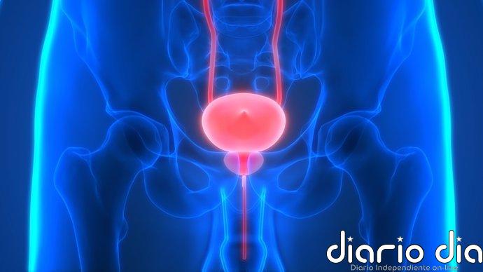 Crean el mapa celular más detallado del cáncer de próstata y descubren células 'aparentemente sanas' ya en modo tumoral