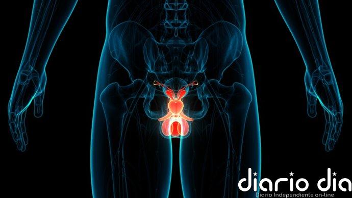 El cáncer de testículo aumenta en hombres jóvenes, según el Instituto de Cirugía Urológica Avanzada