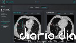 Eurecat aboga por la IA y la robótica para una salud "más preventiva, equitativa y personalizada"