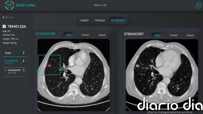 Eurecat aboga por la IA y la robótica para una salud "más preventiva, equitativa y personalizada"
