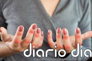 Las enfermedades autoinmunes podrían tener un origen genético oculto en las células inmunitarias