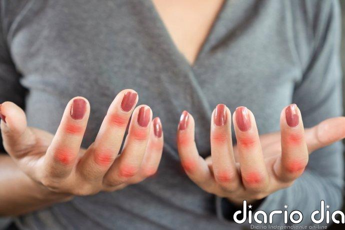 Las enfermedades autoinmunes podrían tener un origen genético oculto en las células inmunitarias