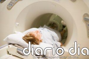 Las técnicas de Medicina Nuclear: el avance "clave" en el diagnóstico precoz del Parkinson