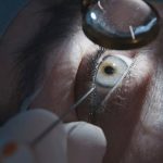 Moscas volantes y destellos en el ojo: Cuándo son normales y cuándo alertan de un problema grave