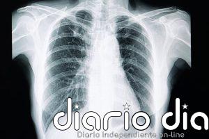 Ni radiólogos ni IA distinguen estas radiografías 'deepfake': un estudio alerta de un nuevo riesgo para la sanidad