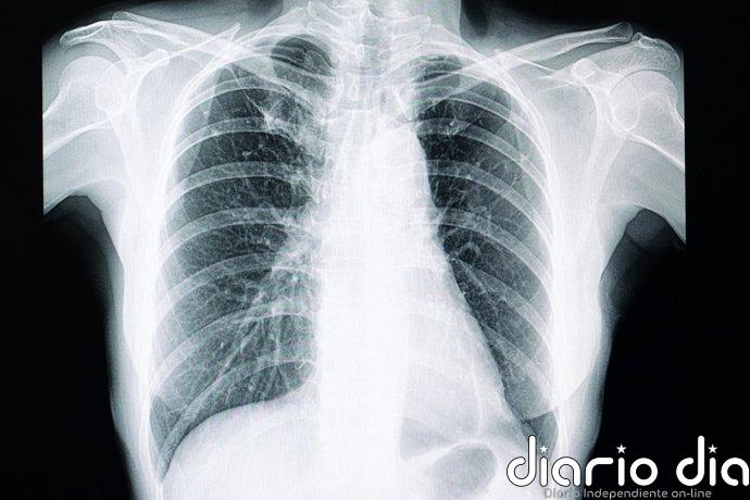 Ni radiólogos ni IA distinguen estas radiografías 'deepfake': un estudio alerta de un nuevo riesgo para la sanidad