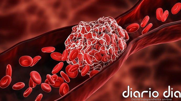 Un nuevo stent podría acabar con el dolor crónico de piernas tras un trombo y devolver la movilidad a miles de pacientes