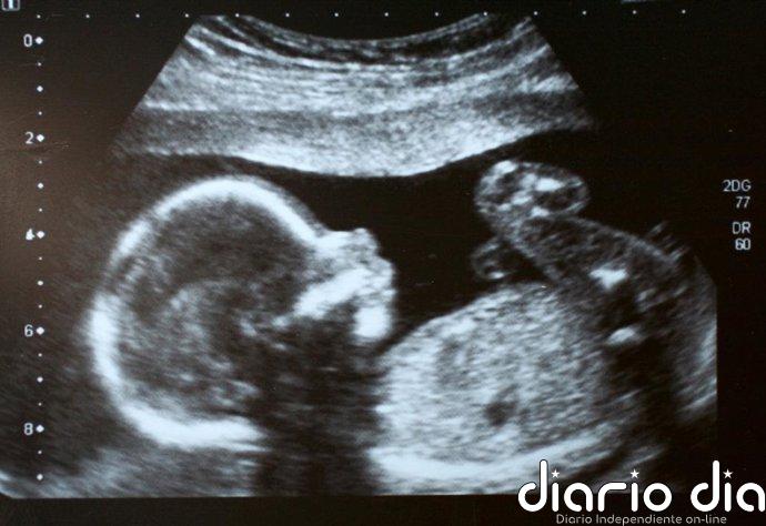 Cuando la presión arterial de la madre condiciona el corazón del hijo