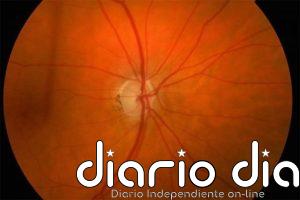 Descubren un 'equipo de limpieza' en el ojo que podría ayudar a prevenir la ceguera