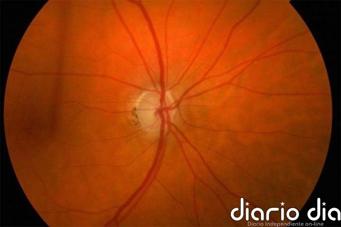 Descubren un 'equipo de limpieza' en el ojo que podría ayudar a prevenir la ceguera