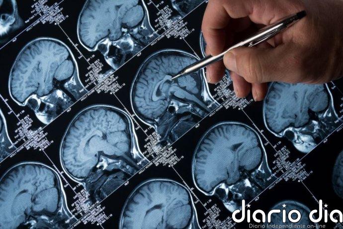 España es pionera en el desarrollo de nuevos ensayos clínicos y tratamientos dirigidos a la epilepsia, destaca SENEP