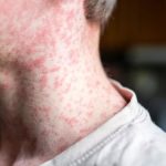 GHP-88310: cómo actúa el candidato antiviral frente a los ortoparamixovirus