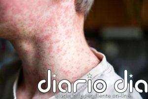 GHP-88310: cómo actúa el candidato antiviral frente a los ortoparamixovirus