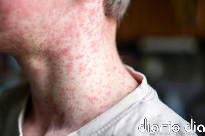 GHP-88310: cómo actúa el candidato antiviral frente a los ortoparamixovirus
