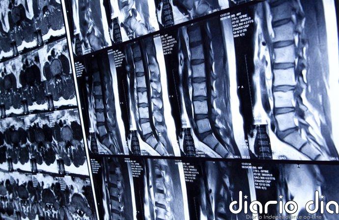 La "grasa oculta" en tu espalda: el nuevo indicador que la IA utiliza para predecir infartos antes de que den la cara