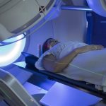 La radioterapia guiada por superficie permite evitar los tatuajes permanentes en pacientes de cáncer