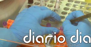 Realización y análisis de los PCR de hantavirus