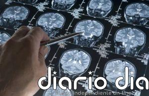 Alzheimer: descubren el 'caballo de Troya' celular que la enfermedad utiliza para destruir el cerebro