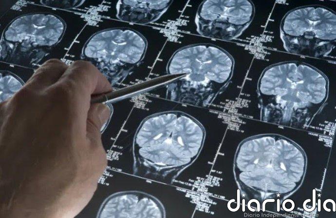 Alzheimer: descubren un nuevo método que detecta el doble de casos antes de los síntomas