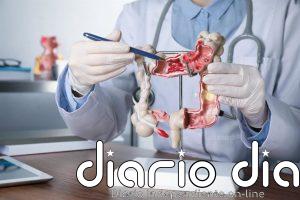 Identifican un mecanismo molecular "relevante" en la progresión del cáncer colorrectal y su metástasis