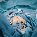 La cirugía bariátrica en adolescentes con obesidad severa resulta coste-efectiva a 10 años