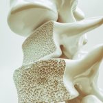 La terapia hormonal en la menopausia protege los huesos: reduce un 69% el riesgo de osteoporosis
