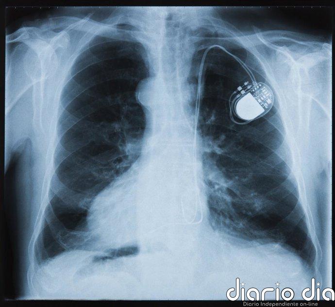 Novedades en cuanto a los marcapasos biológicos: TBX18 falla, pero Hcn2 funciona