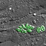 Piden a la OMS reconocer la toxoplasmosis ocular como enfermedad tropical desatendida: afecta a 1 de cada 3 personas