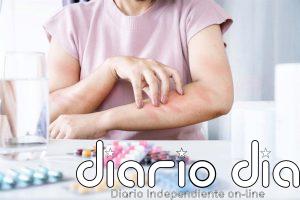 ¿Puede aparecer una alergia a un medicamento después de años tomándolo? Atención a estos fármacos