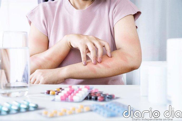 ¿Puede aparecer una alergia a un medicamento después de años tomándolo? Atención a estos fármacos