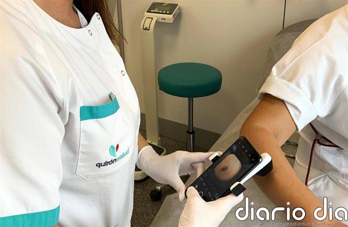 Quirónsalud Andalucía insiste en la importancia de la protección solar y la detección precoz frente al cáncer de piel