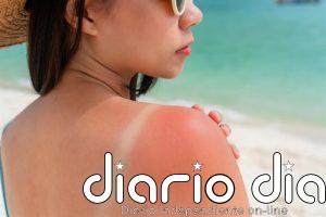 Reacciones cutáneas al sol: cuáles son, cómo identificarlas y cuándo preocuparse